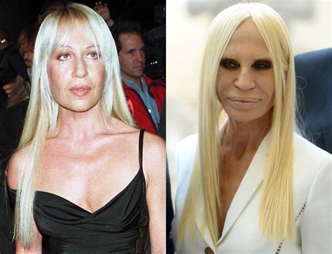 donatella versace anni 90|donatella versace before and after.